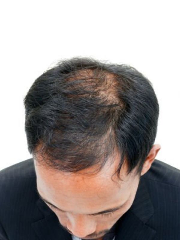 Image Before