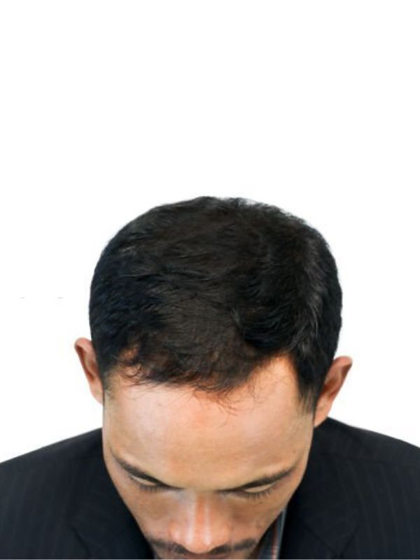 Image Before
