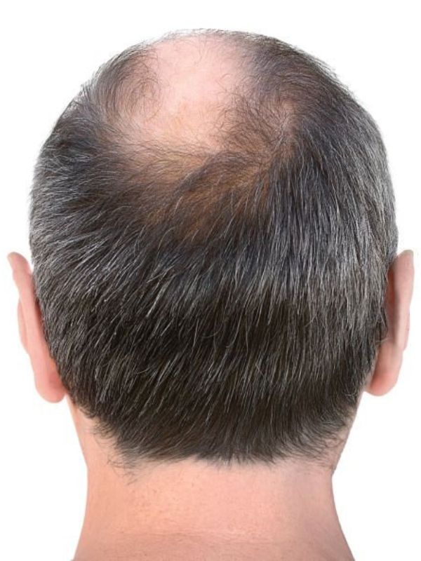 Image Before